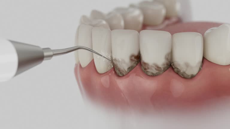 Trusted Dental Implants service in Santa Ana, CA - Dentist Open Now